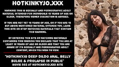 Hotkinkyjo deep dildo anal, belly bulge &amp_ prolapse in public Thumb