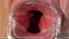 teen blonde sarah gyno speculum pussy gaping closeups and peeing Thumb